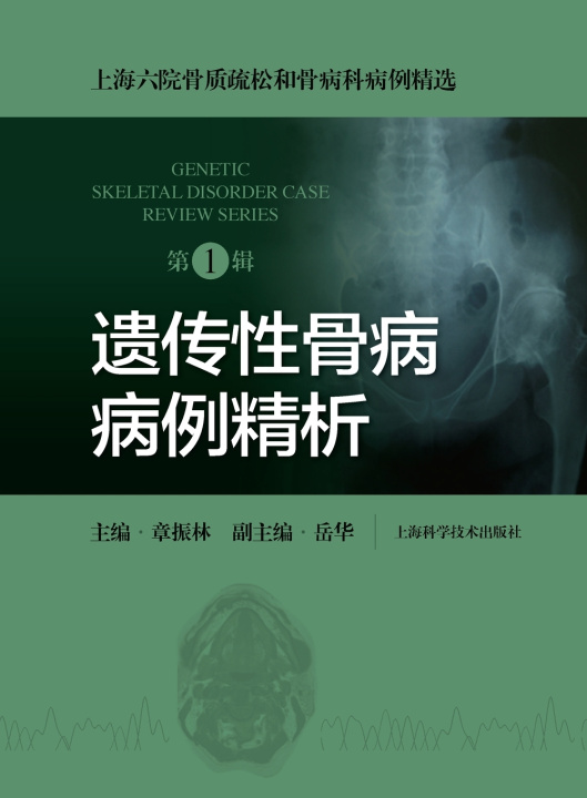Libro Essentials of Hereditary Bone Disease Cases 章振林 主编
