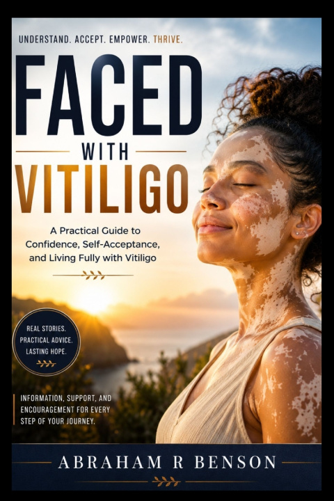 Kniha Faced with vitiligo Abraham R Benson