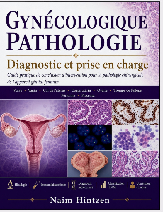Kniha GYNÉCOLOGIQUE PATHOLOGIE Diagnostic et prise en charge Naim Hintzen