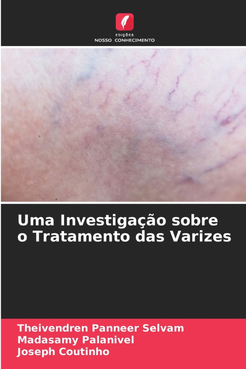 Carte Uma Investigação sobre o Tratamento das Varizes Theivendren Panneer Selvam