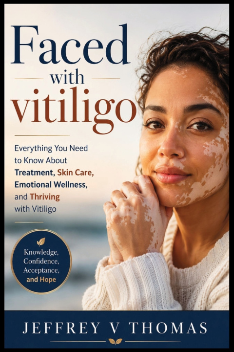 Carte Faced with vitiligo Jeffrey V Thomas