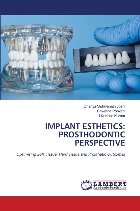 Könyv IMPLANT ESTHETICS Dhanya Vishwanath Joshi