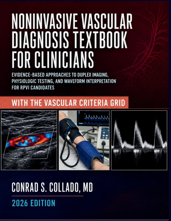 Książka Noninvasive Vascular Diagnosis Textbook for Clinicians Conrad S. Collado MD