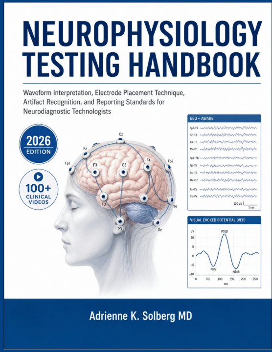 Knjiga NEUROPHYSIOLOGY TESTING HANDBOOK Adrienne K. Solberg MD