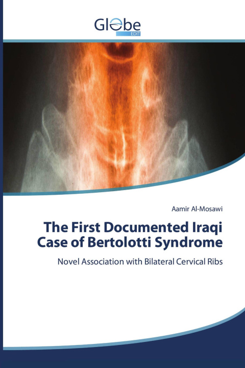 Книга The First Documented Iraqi Case of Bertolotti Syndrome 