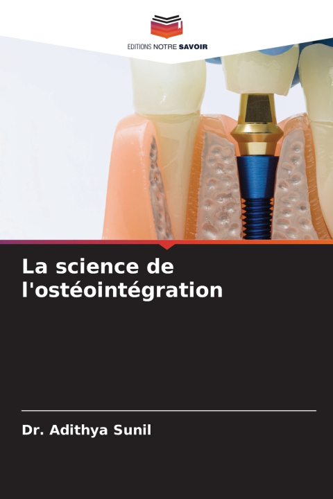Книга La science de l'ostéointégration 