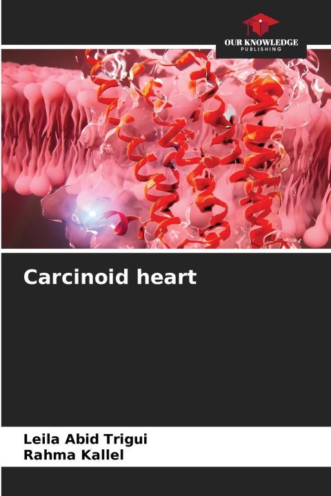 Libro Carcinoid heart Leila Abid Trigui