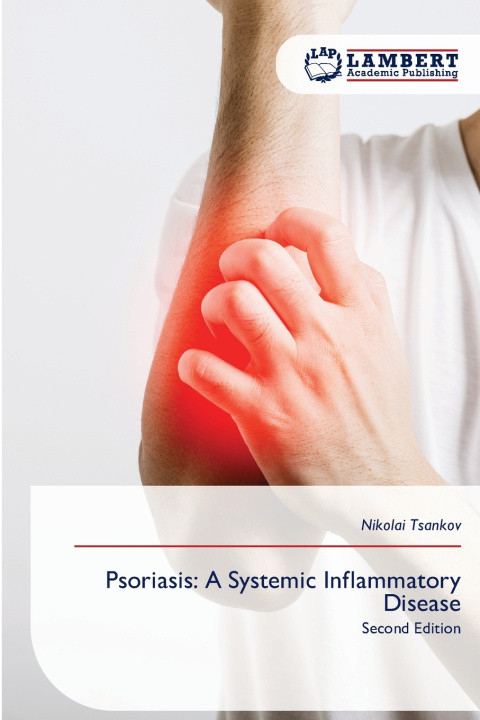 Book Psoriasis Nikolai Tsankov