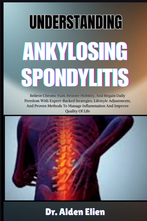 Buch UNDERSTANDING ANKYLOSING SPONDYLITIS Dr. Alden Elien