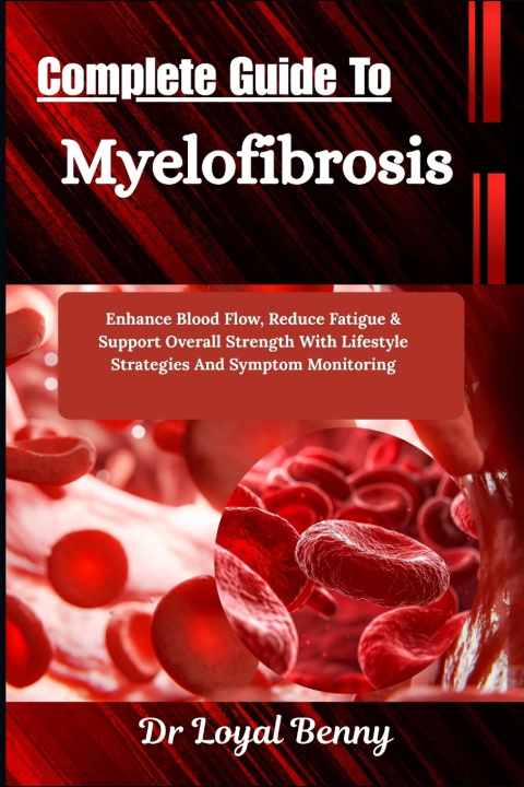 Libro Complete Guide To Myelofibrosis Dr. Loyal Benny
