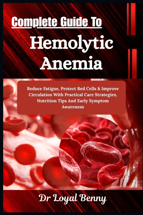 Libro Complete Guide To Hemolytic Anemia Dr. Loyal Benny
