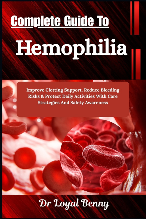 Buch Complete Guide To Hemophilia Dr. Loyal Benny