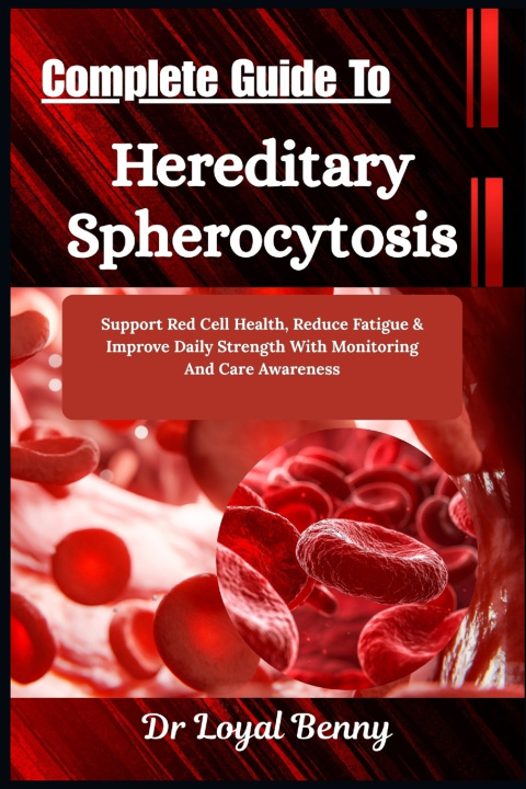 Buch Complete Guide To Hereditary Spherocytosis Dr. Loyal Benny