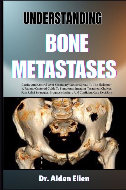Libro UNDERSTANDING BONE METASTASES Dr. Alden Elien