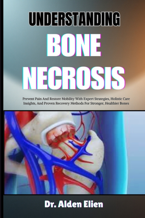 Buch UNDERSTANDING BONE NECROSIS Dr. Alden Elien
