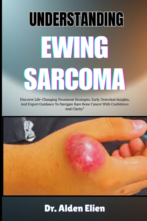 Libro UNDERSTANDING EWING SARCOMA Dr. Alden Elien