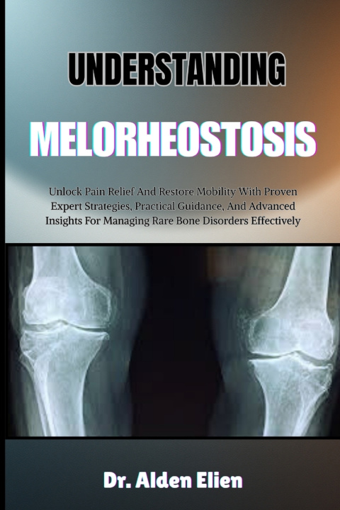 Libro UNDERSTANDING MELORHEOSTOSIS Dr. Alden Elien