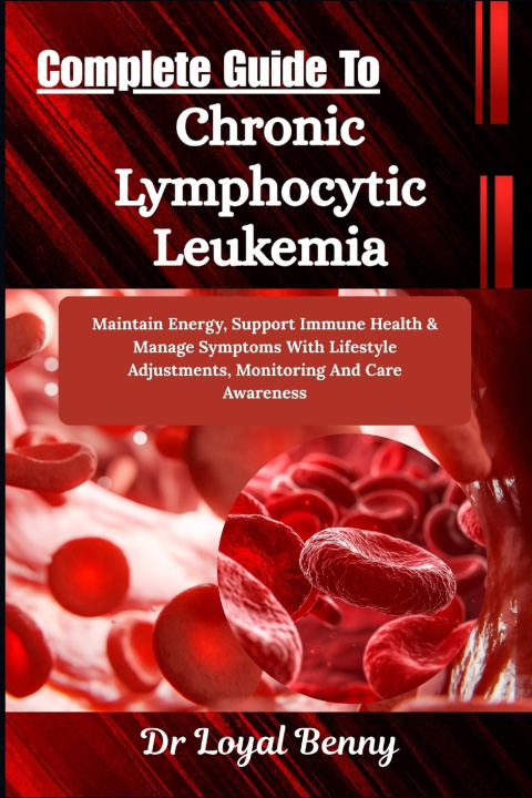 Buch Complete Guide To Chronic Lymphocytic Leukemia Dr. Loyal Benny