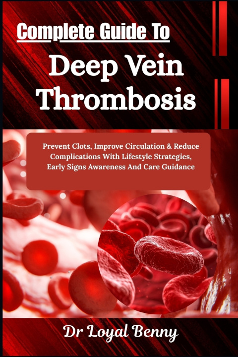 Buch Complete Guide To Deep Vein Thrombosis Dr. Loyal Benny