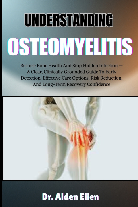 Buch UNDERSTANDING OSTEOMYELITIS Dr. Alden Elien