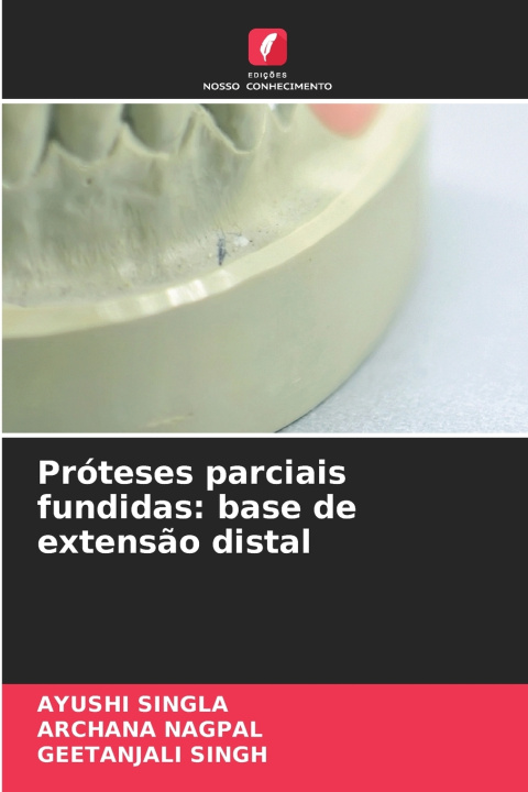 Libro Próteses parciais fundidas Ayushi Singla