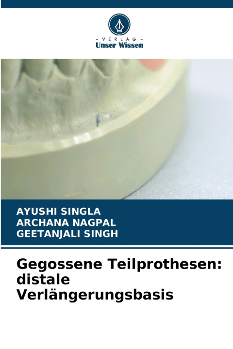 Книга Gegossene Teilprothesen Ayushi Singla