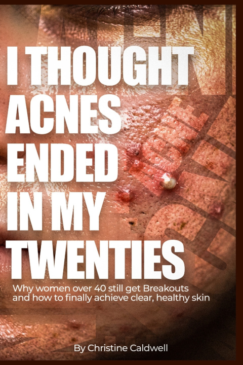 Buch I THOUGHT ACNE ENDED IN MY TWENTIES CHRISTINE CALDWELL