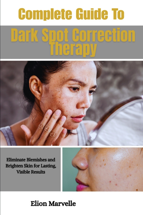 Книга Complete Guide To Dark Spot Correction Therapy Elion Marvelle