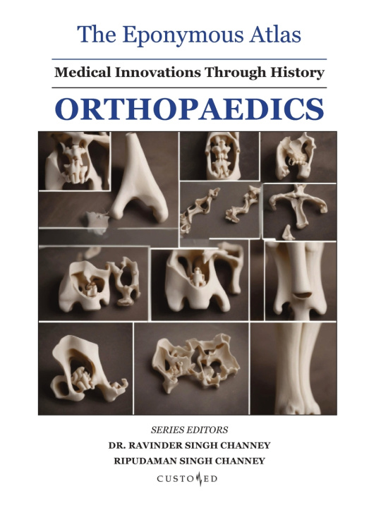 Knjiga The Eponymous Atlas | Orthopaedics Dr. Ravinder Singh Channey