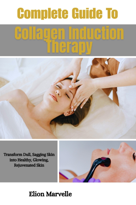 Boek Complete Guide To Collagen Induction Therapy Elion Marvelle