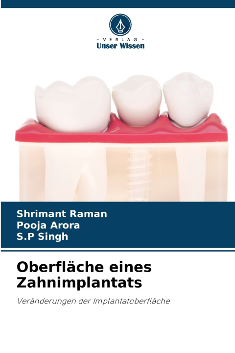 Boek Oberfläche eines Zahnimplantats Shrimant Raman