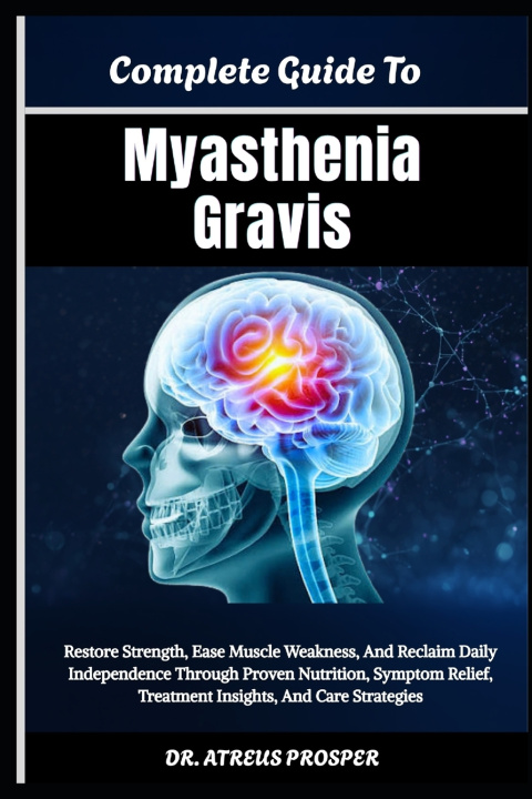 Libro Complete Guide To Myasthenia Gravis Atreus Prosper