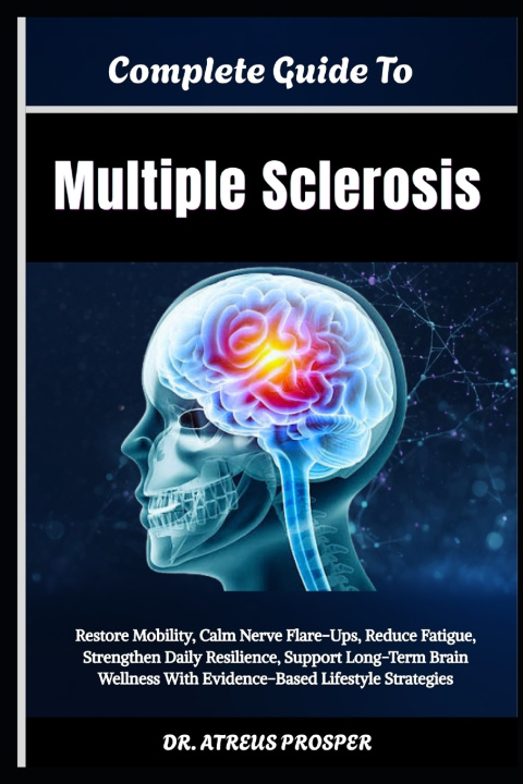 Knjiga Complete Guide To Multiple Sclerosis Atreus Prosper