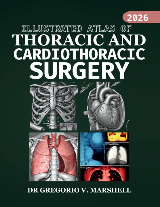 Kniha ILLUSTRATED ATLAS OF THORACIC AND CARDIOTHORACIC SURGERY DR. GREGORIO V. MARSHELL