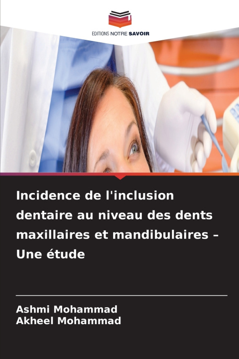 Libro Incidence de l'inclusion dentaire au niveau des dents maxillaires et mandibulaires - Une étude Ashmi Mohammad