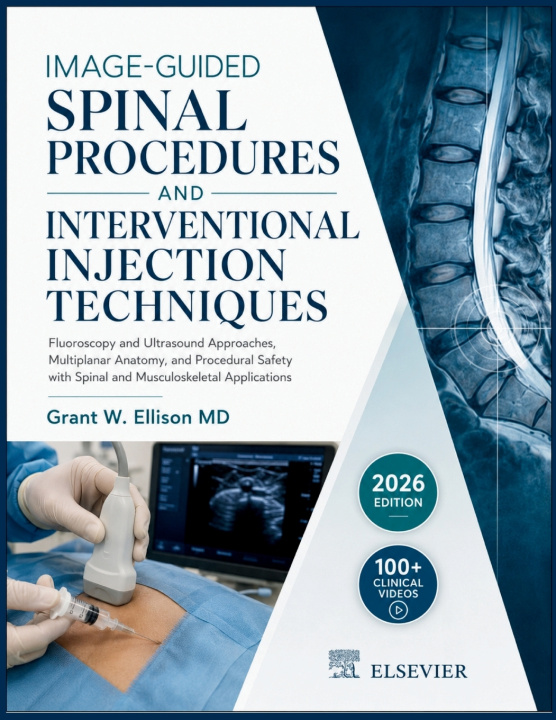Kniha IMAGE-GUIDED SPINAL PROCEDURES AND INTERVENTIONAL INJECTION TECHNIQUES Grant W. Ellison MD