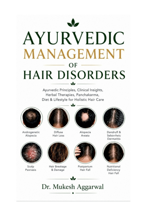 Könyv AYURVEDIC MANAGEMENT OF HAIR DISORDERS Dr Mukesh Aggarwal