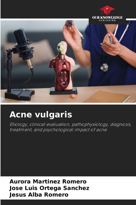 Libro Acne vulgaris Aurora Martínez Romero