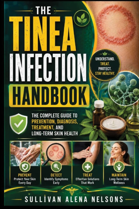 Buch The Tinea Infection Handbook Sullivan Alena Nelsons