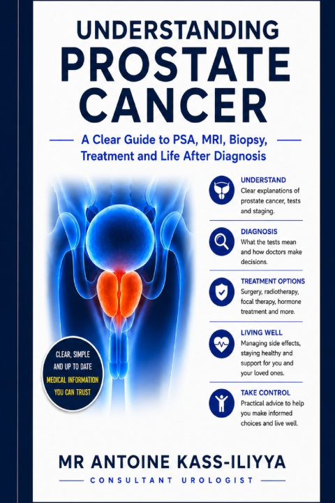 Knjiga Understanding Prostate Cancer Antoine Kass-Iliyya