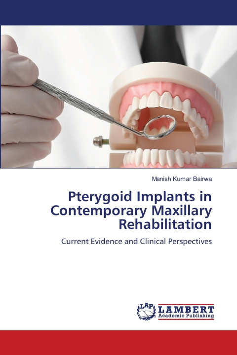 Knjiga Pterygoid Implants in Contemporary Maxillary Rehabilitation Manish Kumar Bairwa