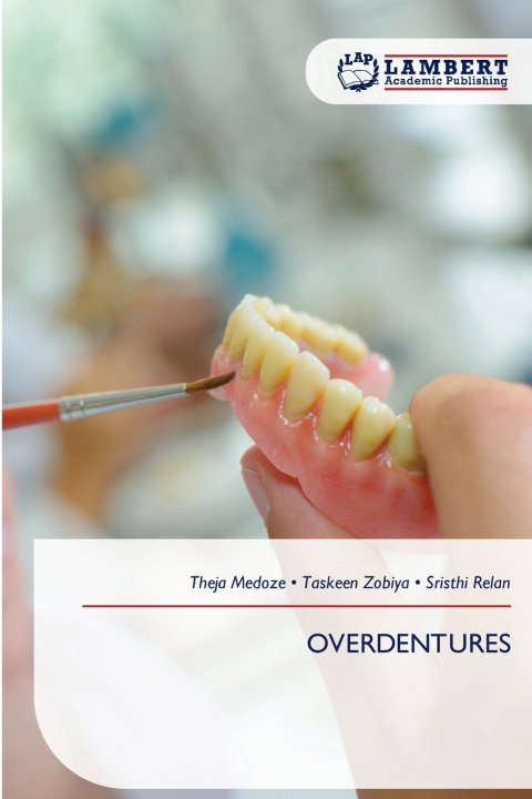Книга OVERDENTURES Theja Medoze