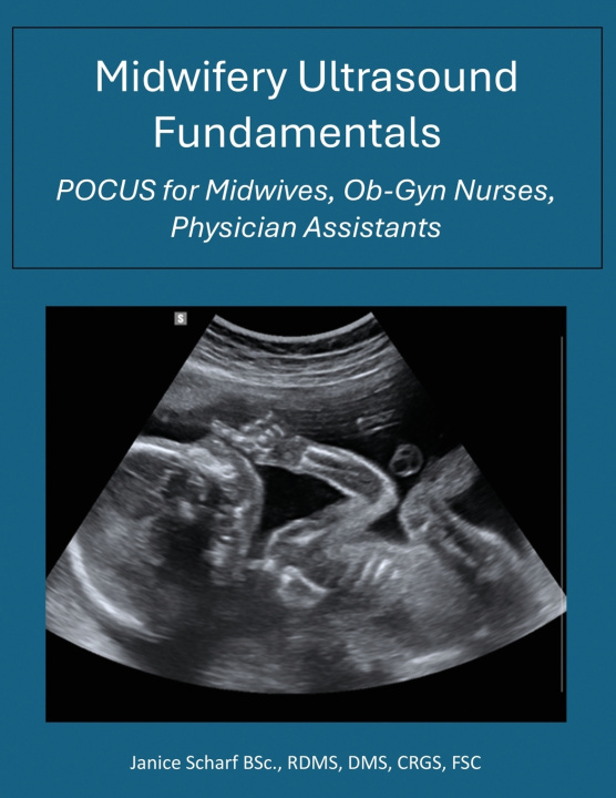 Kniha Midwifery Ultrasound Essentials Janice Hickey Scharf