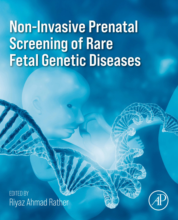 E-Book Non-Invasive Prenatal Screening of Rare Fetal Genetic Diseases Riyaz Ahmad Rather