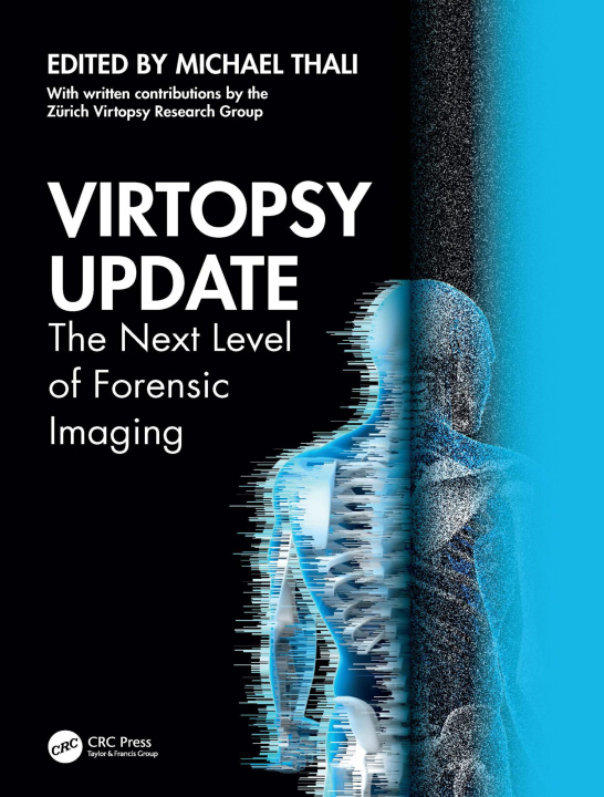 E-kniha Virtopsy Update Michael Thali