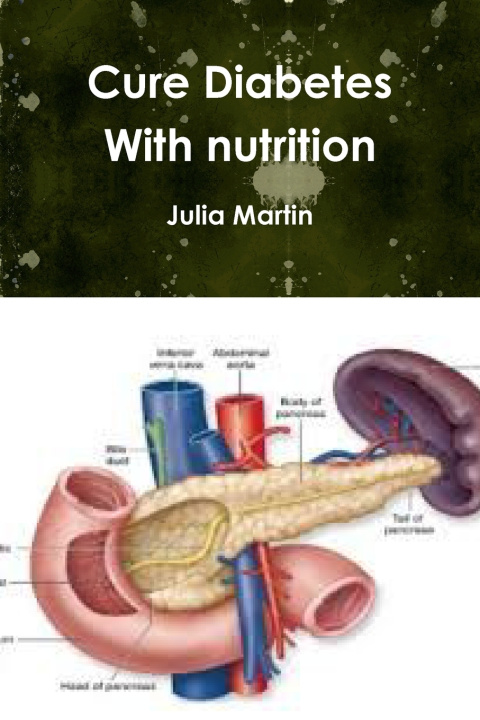 Kniha Cure Diabetes With nutrition Julia Martin