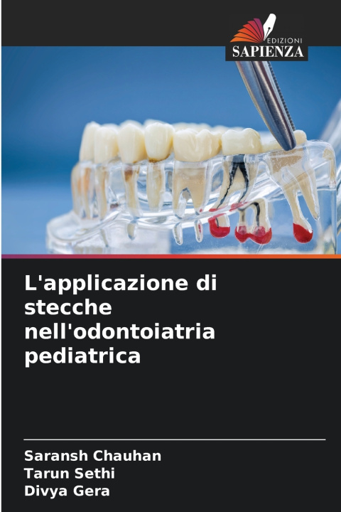 Kniha L'applicazione di stecche nell'odontoiatria pediatrica Saransh Chauhan