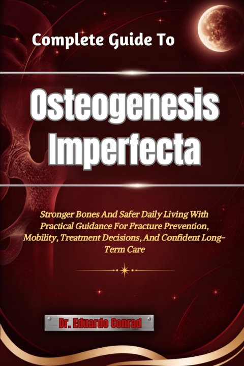 Könyv Complete Guide To Osteogenesis Imperfecta Dr. Eduardo Conrad