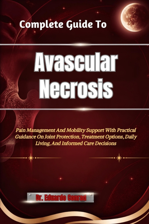 Knjiga Complete Guide To Avascular Necrosis Dr. Eduardo Conrad