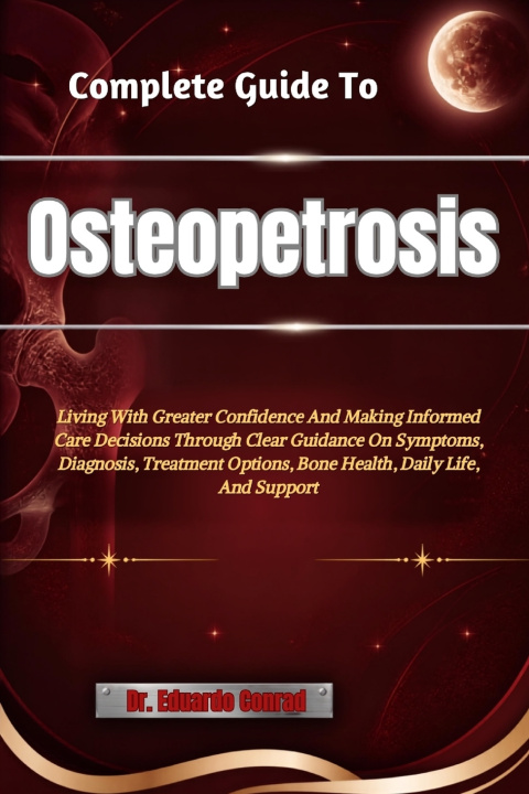Könyv Complete Guide To Osteopetrosis Dr. Eduardo Conrad